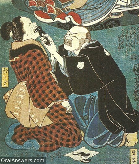 Japanese Dentist Kneeling to Extract Tooth - Dental History