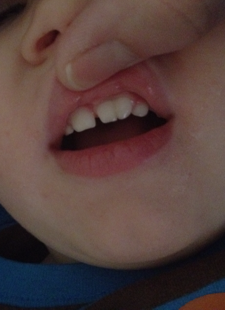 Double Tooth 2 Years Old