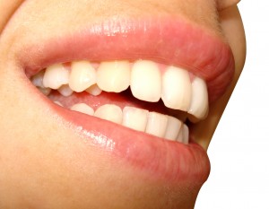 A Beautiful Smile