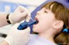 How Long White Composite Fillings Last