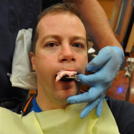 Taking an Alginate Dental Impression - Photo Courtesy of SuperWebDeveloper