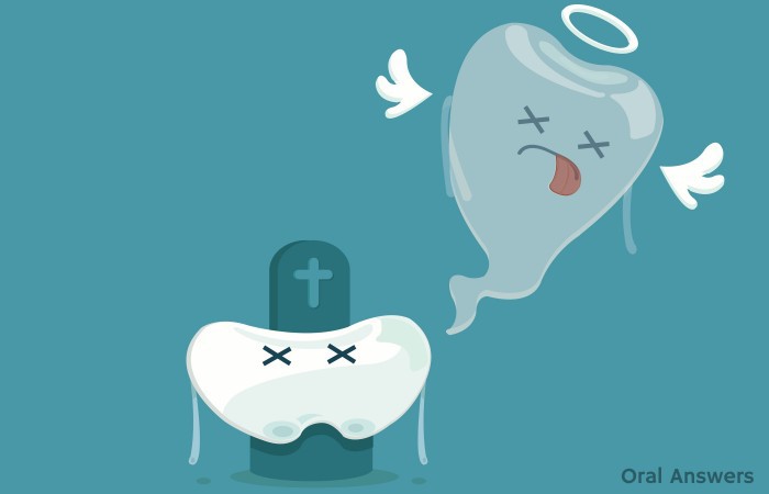 Gum Disease Leads to Tooth Loss
