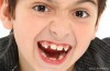 How Spacers Space Maintainers Look In Your Child's Mouth