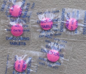 Plaque Disclosing Tablets