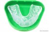 Care of Athletic Mouthguard