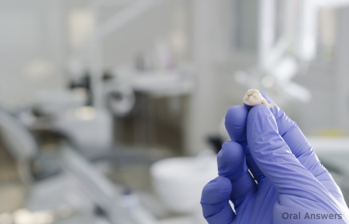 Why Extract Wisdom Teeth?