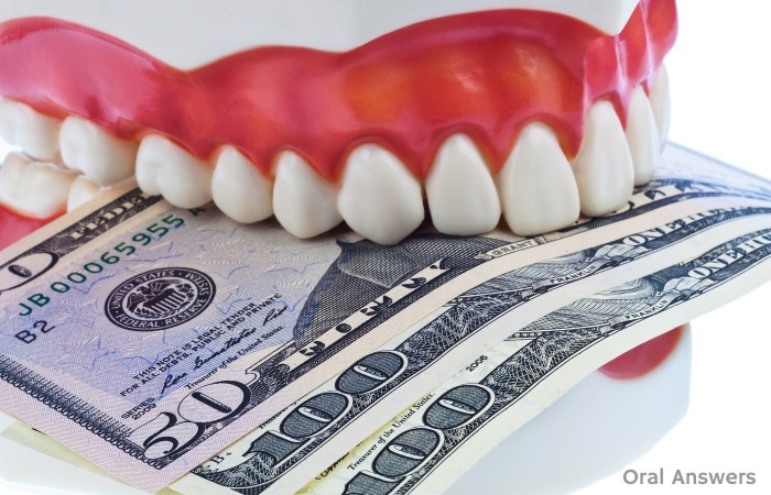 OA Links: Dental Work Expensive