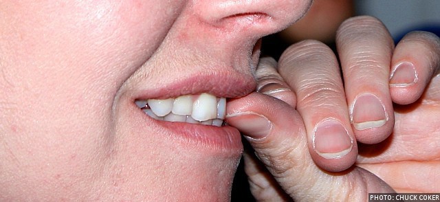 Nail Biting Can Harm Your Teeth. Our teeth can do many amazing things,