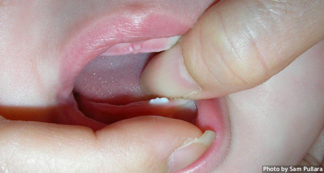 Baby's first deals tooth coming in