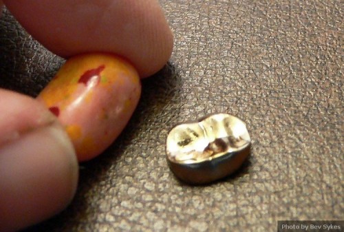 Gold Crown Fell Off