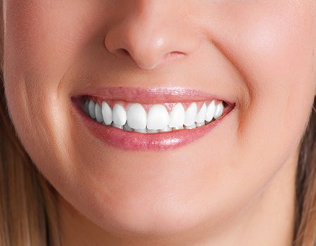 best teeth whitening system 2011