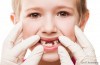 Cavities In Baby Teeth: Do They Need Fillings?