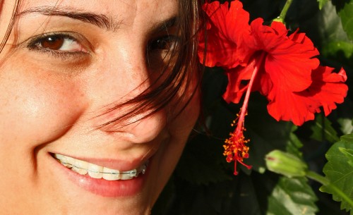 Can General Dentists Offer Braces?