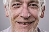 Root Canals Stain Teeth