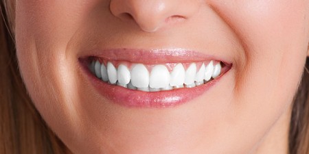 sore gums due to teeth whitening