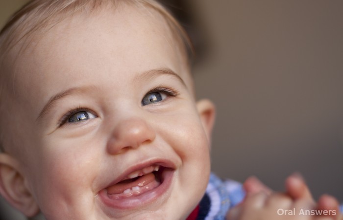 Baby Teething Gel and Methemoglobinemia