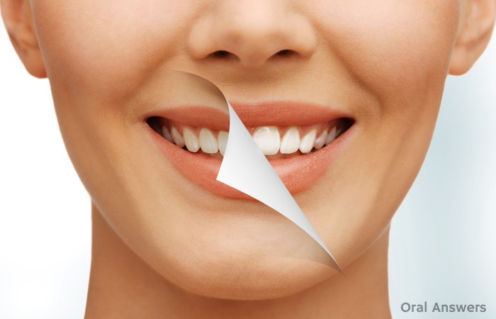 Five Ways to Get Better Teeth