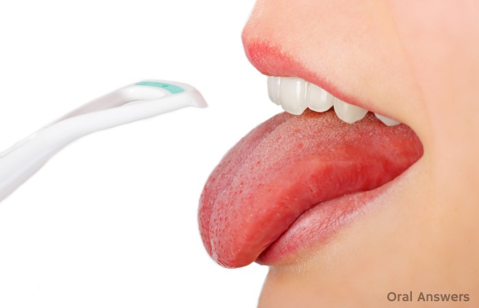Clean Tongue No Bad Breath