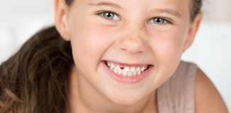 Congenitally Missing Teeth