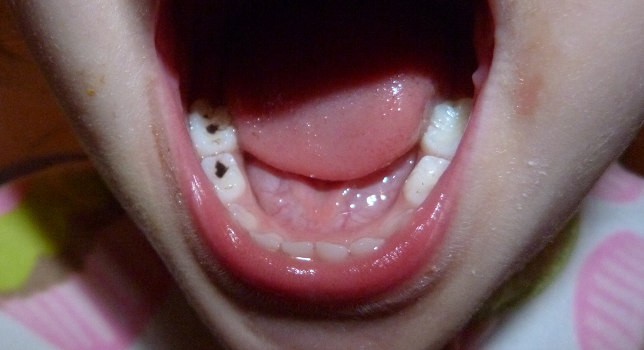Brush Teeth on Halloween