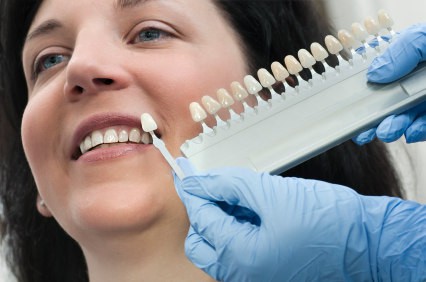 Tooth Shade Guide
