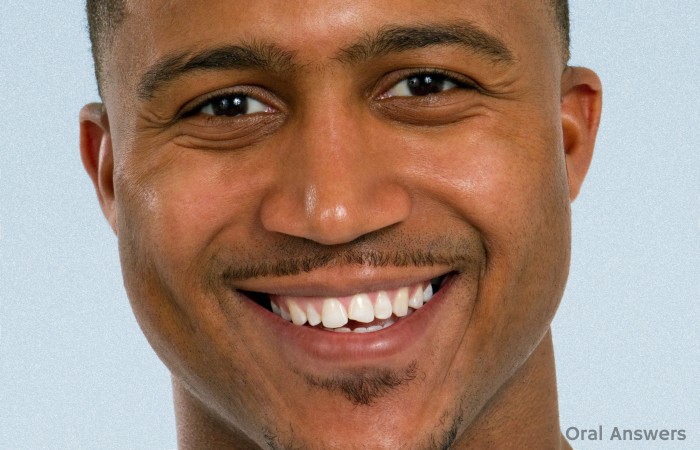 Dental Fillings Fix Chipped Teeth