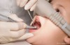 Nitrous Oxide Laughing Gas for Dental Visits