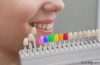 Colored Dental Tooth Fillings