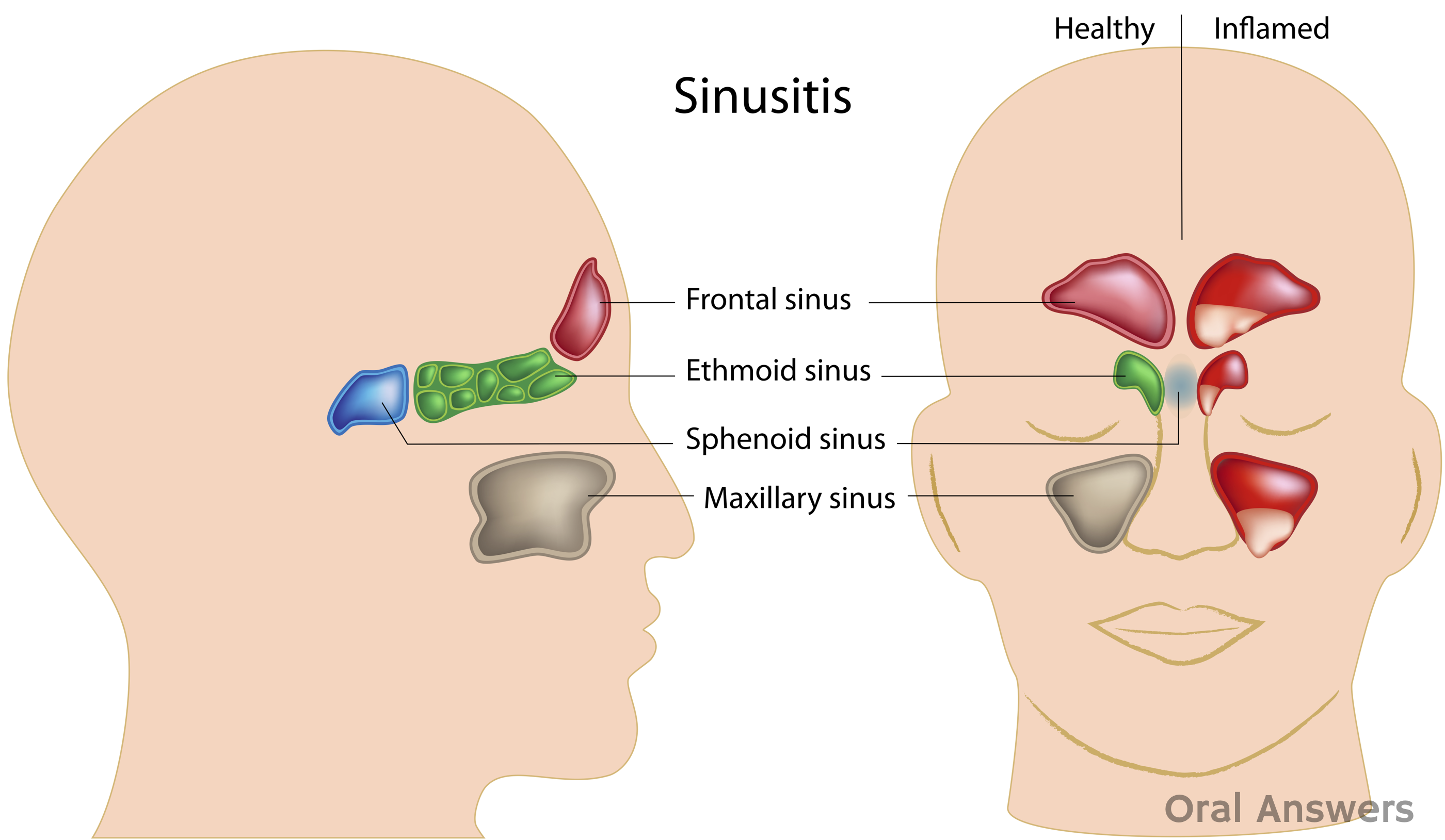 What are common problems that affect the roof of your mouth?