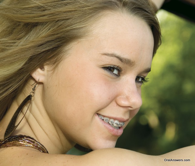 teeny teen with braces