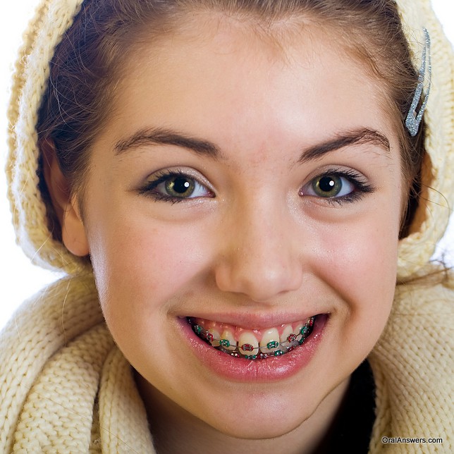 teenage_girl_braces_green_red_hat