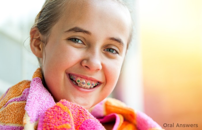 Photos of Teenagers with Braces
