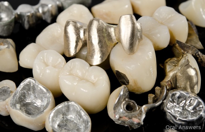 Extracted Teeth Stripped of Scrap Metal