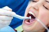 Silver Fillings Last Longer than White Fillings