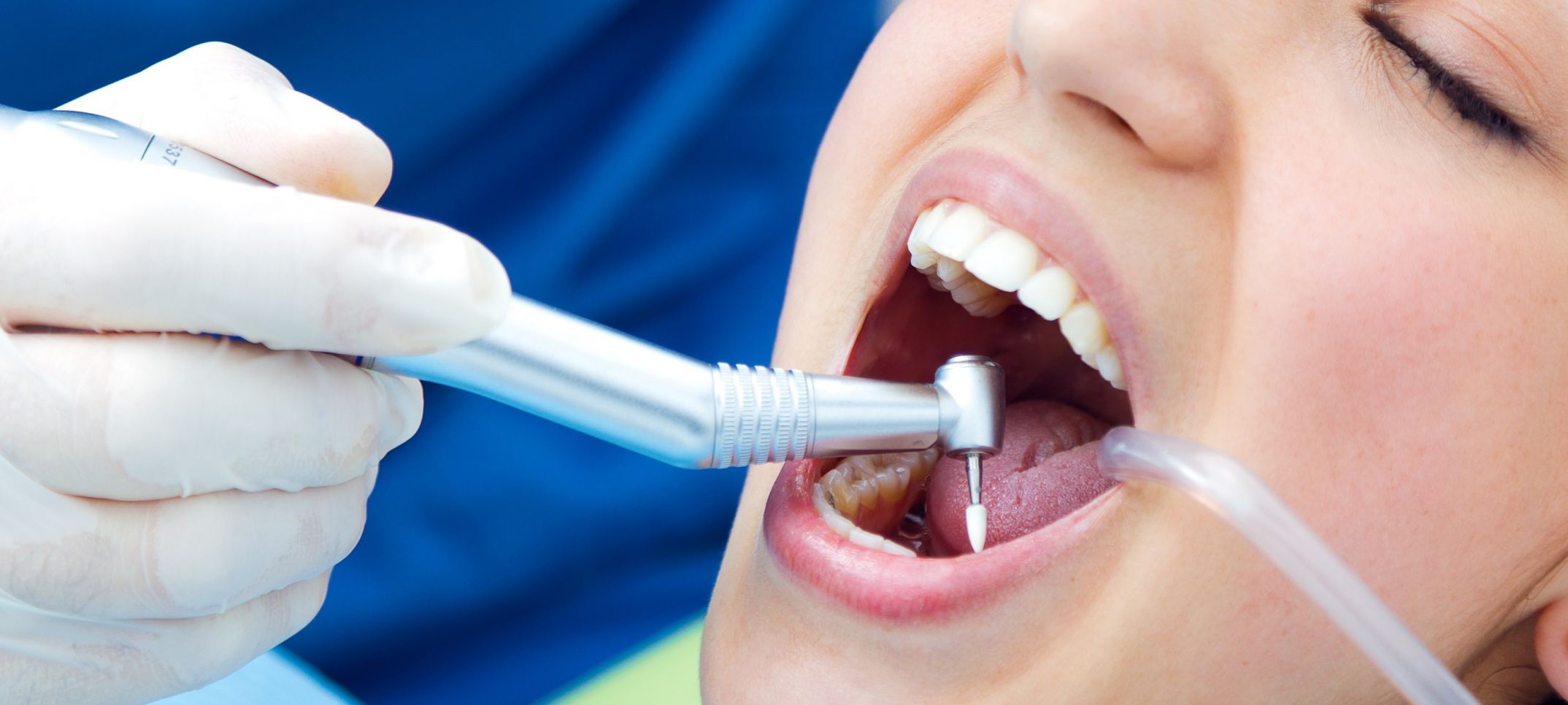 Что делать после лечения зубов. Профессиональная гигиена полости рта. Терапевтическая стоматология зубов.
