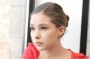 Dental Implants in Teenagers