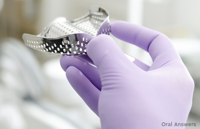 Reasons Dentists Take Impressions of Your Teeth