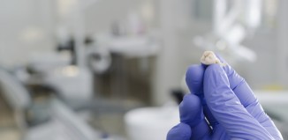 Why Extract Wisdom Teeth?