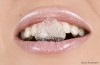 Chewing Ice Cubes Hurts Teeth