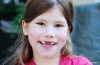 Age that a Child Needs a Frenectomy