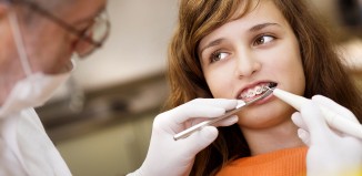 Can General Dentists Do Braces?