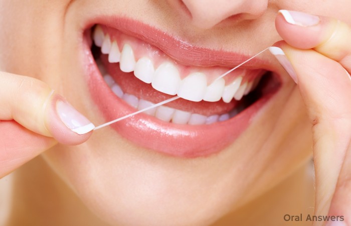 Gums Bleeding When Flossing
