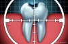 Weapons of Plaque Destruction