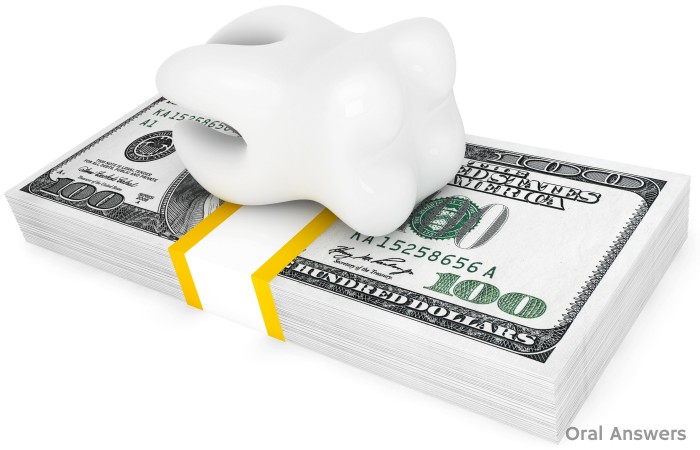 Average Dental Fees In Your Area