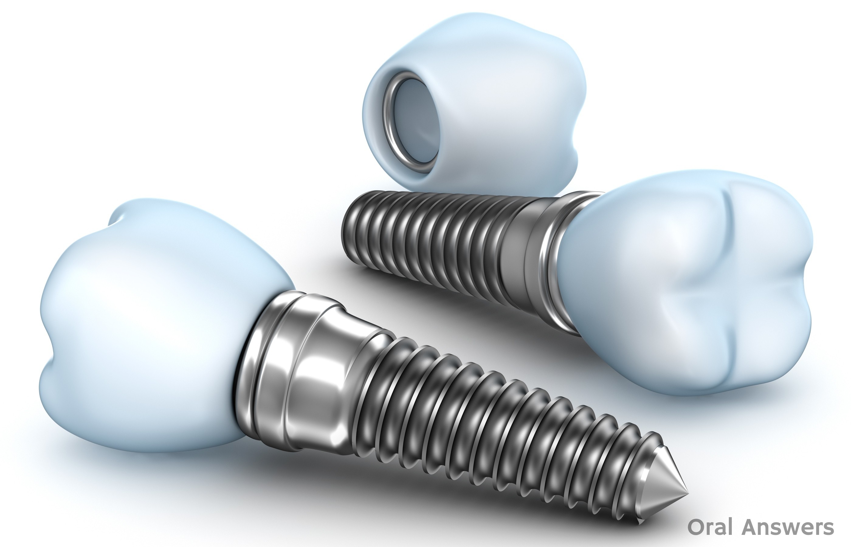 Dental implant Parts