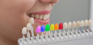 Colored Dental Tooth Fillings