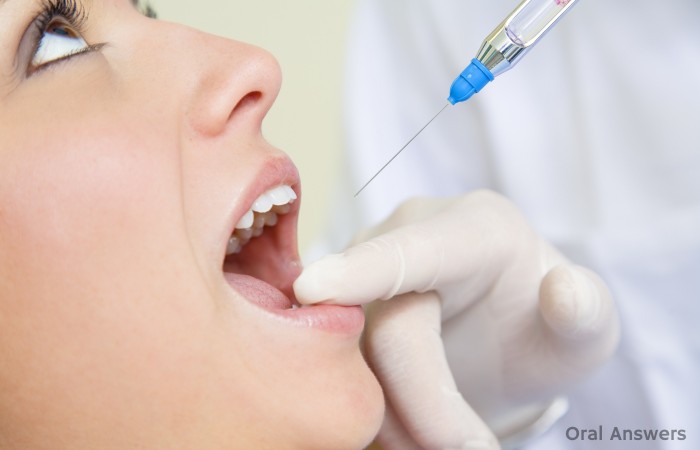 Dental Anesthetic Epinephrine