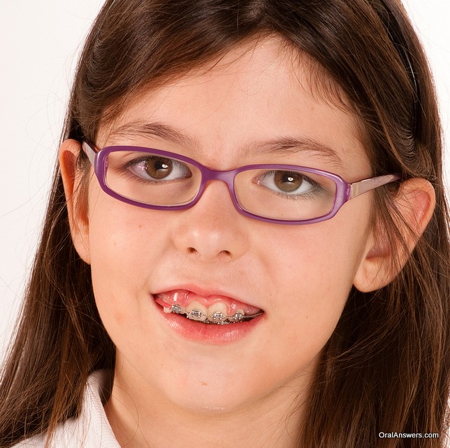 Toys rammed glasses pigtails