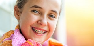 Photos of Teenagers with Braces