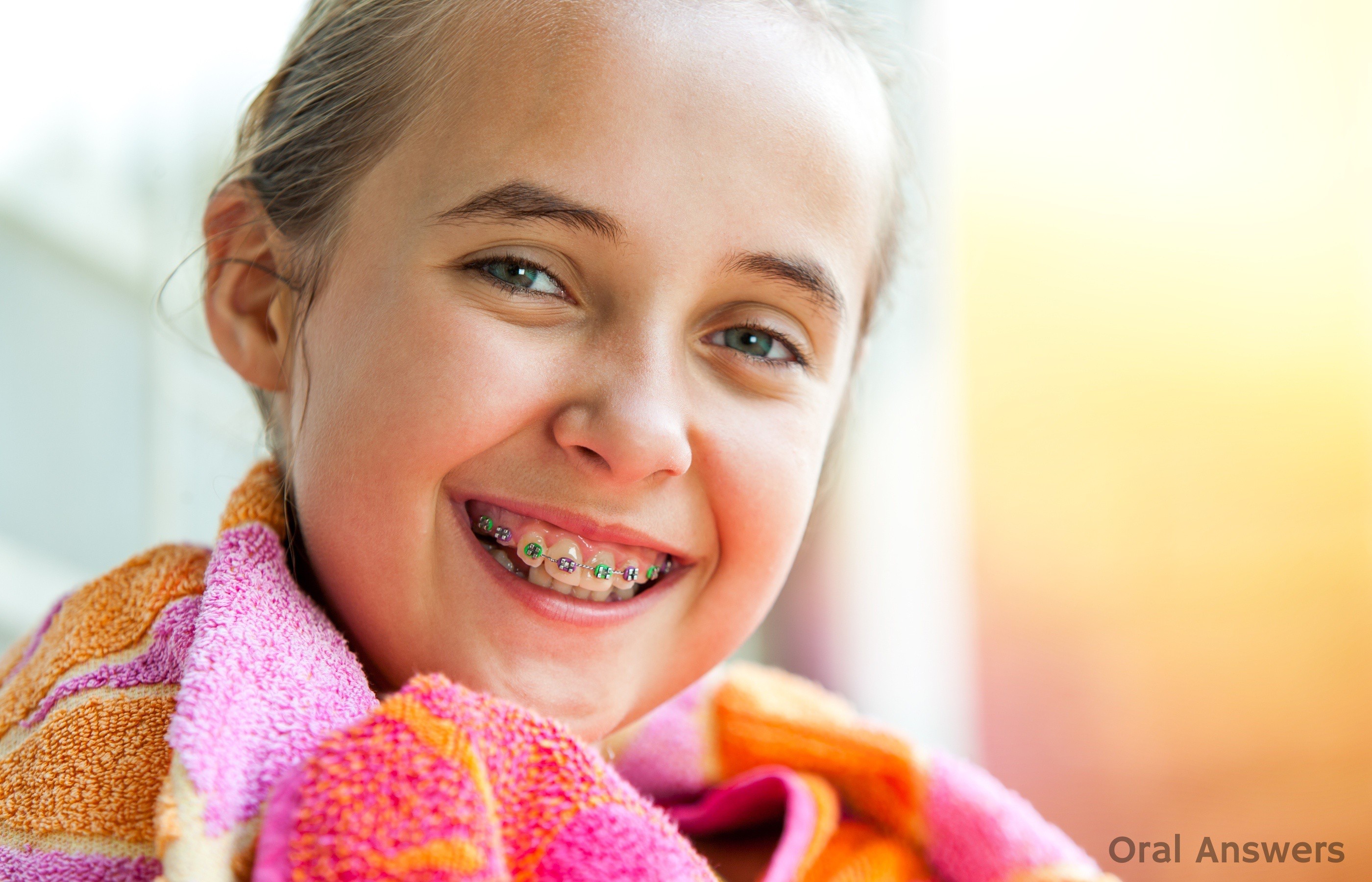 60 Photos of Teenagers with Braces